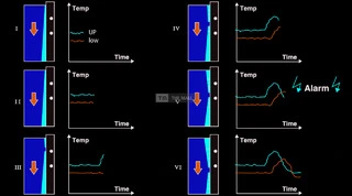 Mold Breakout Prediction System - 2