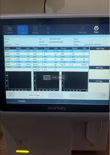 Hematology Analyzer three parts